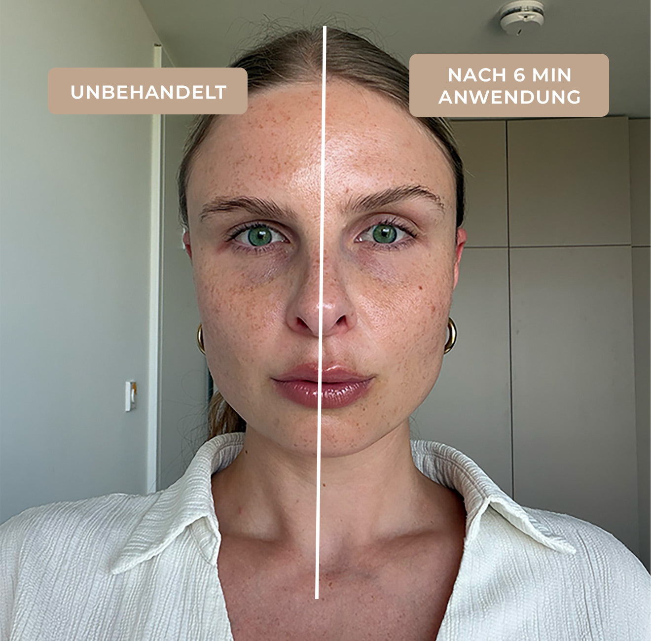 Vorher-Nachher-Vergleich im Gesicht einer Kundin: links unbehandelt, rechts nach 6 Minuten mit dem EMS & Light Therapy Device und dem Lifting Glow Face Serum von The House of Legs
