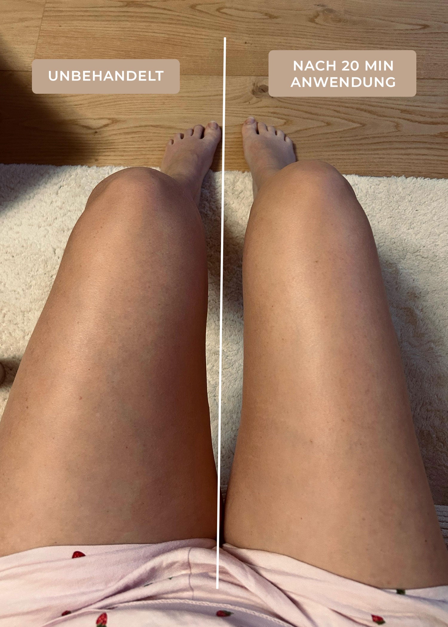 Vorher-Nachher-Vergleich der Beine einer Kundin: links unbehandelt, rechts direkt nach der Anwendung mit LymphGlow Leg Serum und EMS-Gerät von The House of Legs in mehreren Durchgängen à 6 Minuten